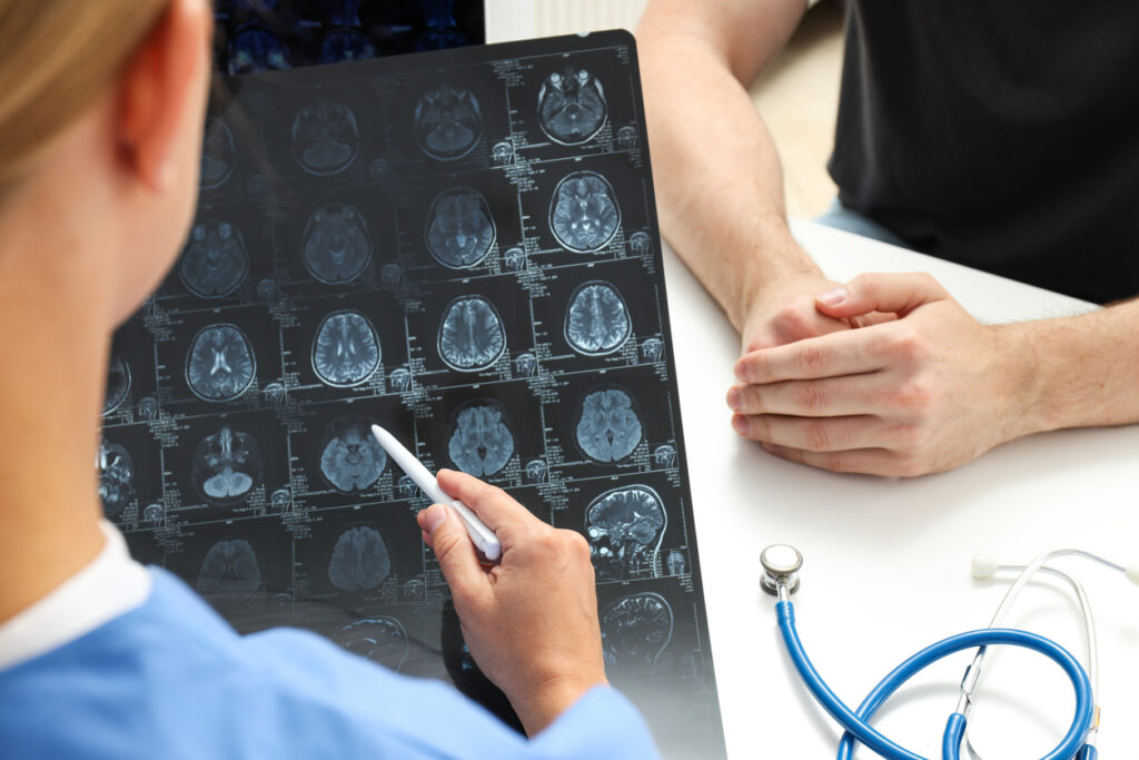 Traumatic Brain Injury Attorney in Norcross, Gwinnett County
